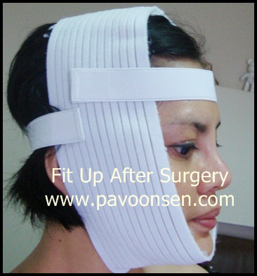 Support Face Bandage รัดกระชับ ลดบวม หลังผ่าตัด
